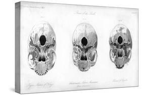 Base of the Skull, 1848-null-Stretched Canvas