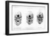 Base of the Skull, 1848-null-Framed Giclee Print