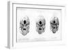 Base of the Skull, 1848-null-Framed Giclee Print