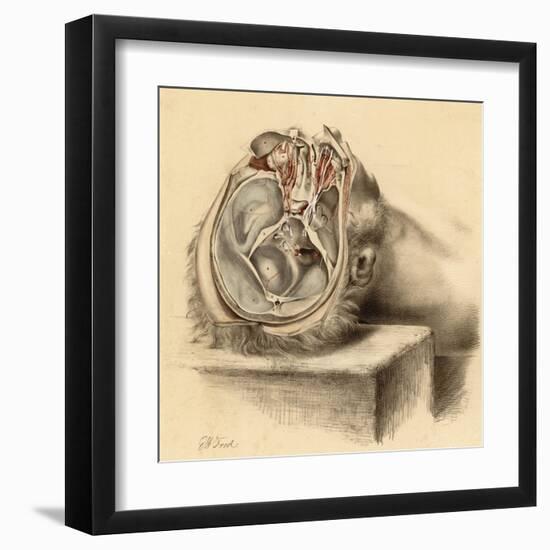 Base of the Skull and Second Views of the Orbit-null-Framed Art Print