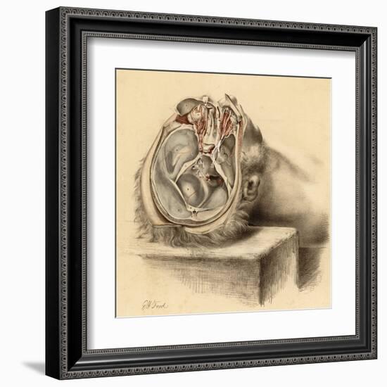 Base of the Skull and Second Views of the Orbit-null-Framed Art Print