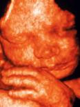 Ultrasound of Foetus' Face-Bernard Benoit-Photographic Print