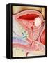 Bladder Cancer-John Bavosi-Framed Stretched Canvas