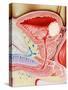 Bladder Cancer-John Bavosi-Stretched Canvas