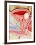 Bladder Cancer-John Bavosi-Framed Photographic Print