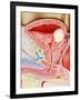 Bladder Cancer-John Bavosi-Framed Photographic Print