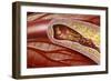 Blocked Coronary Artery, Artwork-John Bavosi-Framed Photographic Print