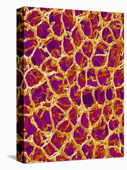 Blood Vessel Cast from Colon of a Rat-Micro Discovery-Stretched Canvas