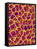 Blood Vessel Cast from Colon of a Rat-Micro Discovery-Framed Stretched Canvas