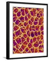 Blood Vessel Cast from Colon of a Rat-Micro Discovery-Framed Photographic Print