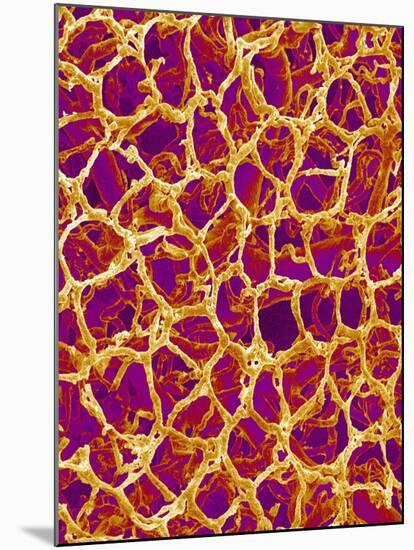 Blood Vessel Cast from Colon of a Rat-Micro Discovery-Mounted Photographic Print