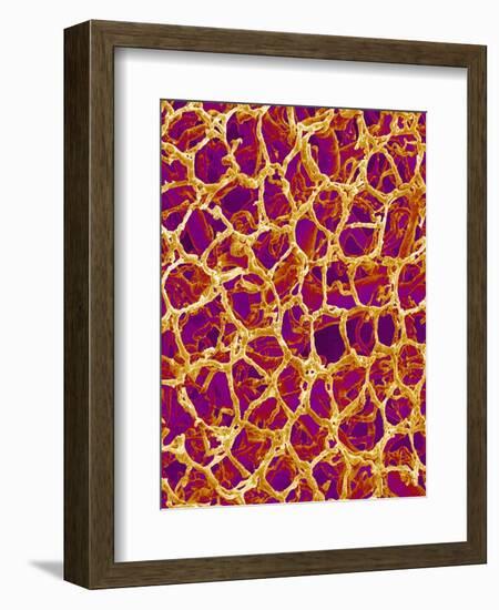 Blood Vessel Cast from Colon of a Rat-Micro Discovery-Framed Photographic Print