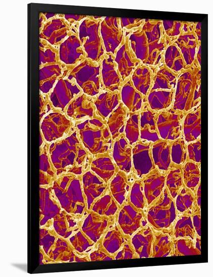 Blood Vessel Cast from Colon of a Rat-Micro Discovery-Framed Photographic Print