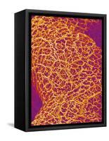 Blood Vessel Cast from Rat Colon-Micro Discovery-Framed Stretched Canvas