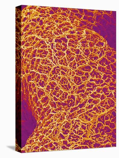 Blood Vessel Cast from Rat Colon-Micro Discovery-Stretched Canvas