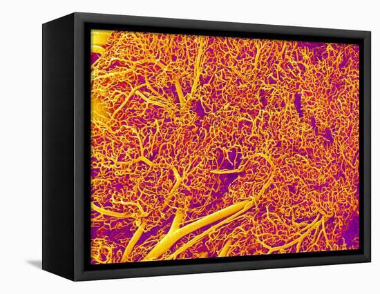 Blood Vessel Cast from Rat Pancreas-Micro Discovery-Framed Stretched Canvas