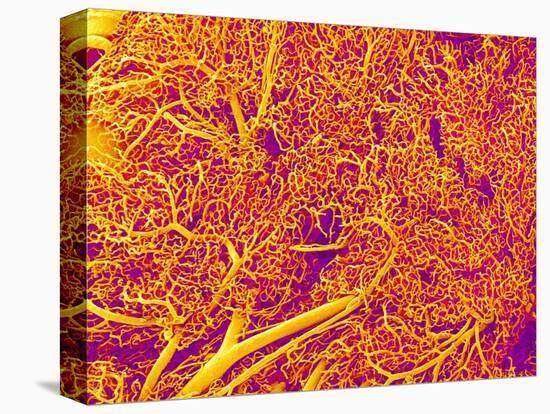 Blood Vessel Cast from Rat Pancreas-Micro Discovery-Stretched Canvas