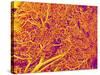 Blood Vessel Cast from Rat Pancreas-Micro Discovery-Stretched Canvas