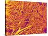 Blood Vessel Cast from Rat Pancreas-Micro Discovery-Stretched Canvas