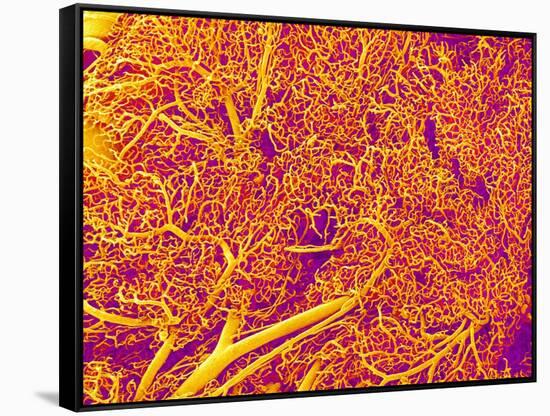 Blood Vessel Cast from Rat Pancreas-Micro Discovery-Framed Stretched Canvas