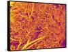 Blood Vessel Cast from Rat Pancreas-Micro Discovery-Framed Stretched Canvas