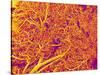 Blood Vessel Cast from Rat Pancreas-Micro Discovery-Stretched Canvas