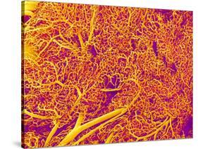 Blood Vessel Cast from Rat Pancreas-Micro Discovery-Stretched Canvas