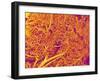 Blood Vessel Cast from Rat Pancreas-Micro Discovery-Framed Premium Photographic Print
