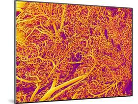 Blood Vessel Cast from Rat Pancreas-Micro Discovery-Mounted Premium Photographic Print