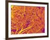 Blood Vessel Cast from Rat Pancreas-Micro Discovery-Framed Photographic Print