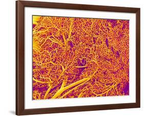 Blood Vessel Cast from Rat Pancreas-Micro Discovery-Framed Photographic Print