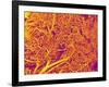 Blood Vessel Cast from Rat Pancreas-Micro Discovery-Framed Photographic Print