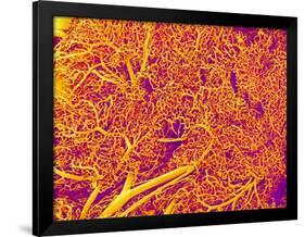 Blood Vessel Cast from Rat Pancreas-Micro Discovery-Framed Photographic Print