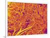 Blood Vessel Cast from Rat Pancreas-Micro Discovery-Framed Photographic Print