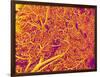 Blood Vessel Cast from Rat Pancreas-Micro Discovery-Framed Photographic Print