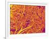 Blood Vessel Cast from Rat Pancreas-Micro Discovery-Framed Photographic Print