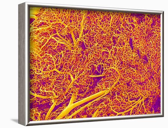 Blood Vessel Cast from Rat Pancreas-Micro Discovery-Framed Photographic Print