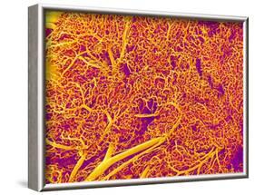 Blood Vessel Cast from Rat Pancreas-Micro Discovery-Framed Photographic Print