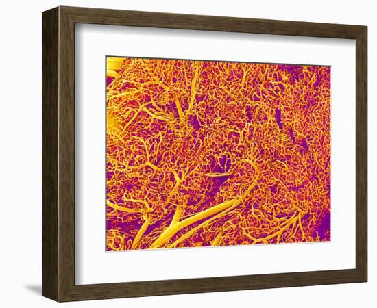 Blood Vessel Cast from Rat Pancreas-Micro Discovery-Framed Photographic Print