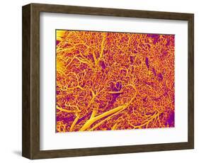 Blood Vessel Cast from Rat Pancreas-Micro Discovery-Framed Photographic Print