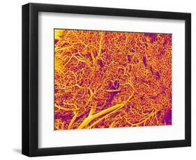 Blood Vessel Cast from Rat Pancreas-Micro Discovery-Framed Photographic Print