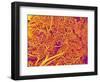 Blood Vessel Cast from Rat Pancreas-Micro Discovery-Framed Photographic Print