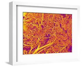 Blood Vessel Cast from Rat Pancreas-Micro Discovery-Framed Photographic Print