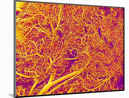 Blood Vessel Cast from Rat Pancreas-Micro Discovery-Mounted Photographic Print