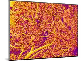 Blood Vessel Cast from Rat Pancreas-Micro Discovery-Mounted Photographic Print