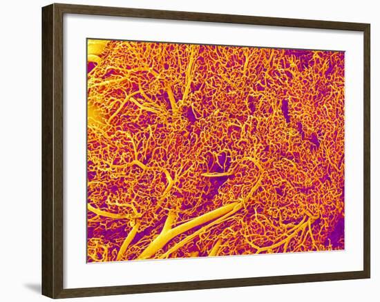Blood Vessel Cast from Rat Pancreas-Micro Discovery-Framed Photographic Print