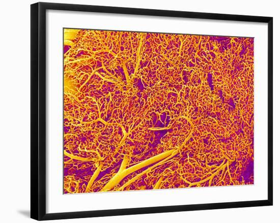 Blood Vessel Cast from Rat Pancreas-Micro Discovery-Framed Photographic Print