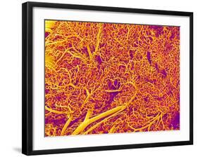 Blood Vessel Cast from Rat Pancreas-Micro Discovery-Framed Photographic Print