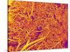 Blood Vessel Cast from Rat Pancreas-Micro Discovery-Stretched Canvas