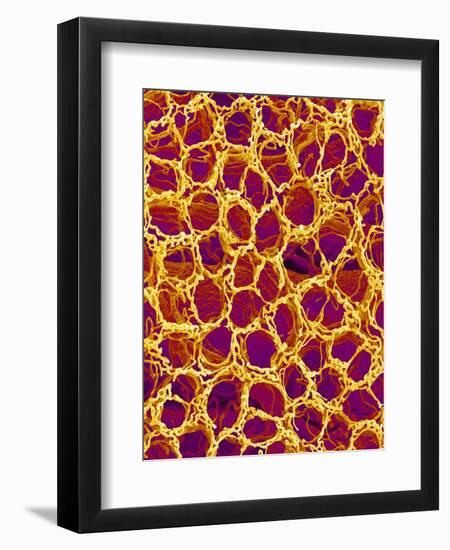 Blood Vessel Cast from Stomach of a Rat-Micro Discovery-Framed Photographic Print